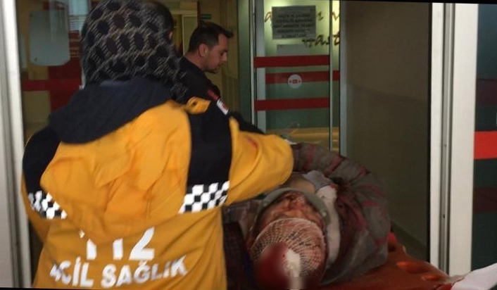 Kafasına parça gelen işçi ağır yaralandı