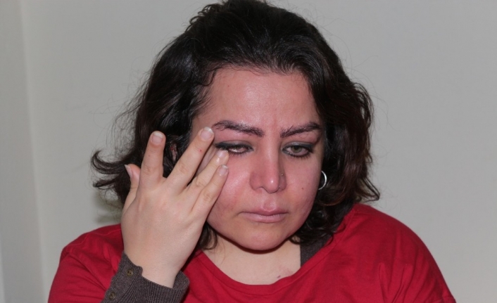 Raşitizm hastası İranlı Bavadi hem iş, hem de tedavi olmak istiyor