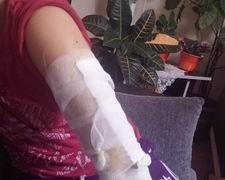 EDREMİT'TE HIDRELEZ ATEŞİ GENCİ AZ DAHA YAKIYORDU