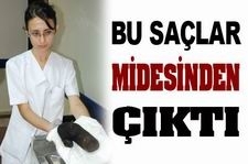 Midesinden 1 kilo saç çıktı