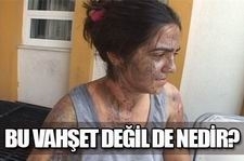 ""ELLERİN KIRILSIN""