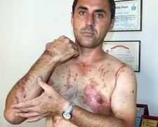 EŞİNE ASİT DÖKTÜĞÜ İDDİA EDİLEN KOCA KONUŞTU: