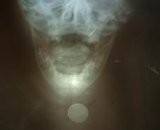 BU ÇOCUĞUN VEBALİNİ HANGİ DOKTOR VERECEK...