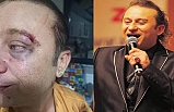 Onur Akay, Akçay'da saldırıya uğradı