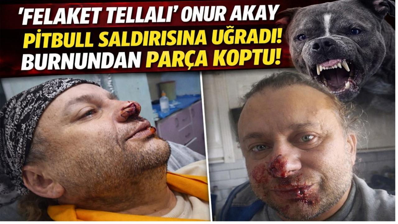 “Felaket Tellalı” Onur Akay’a Pitbull Saldırısı: Burnundan Parça Koptu