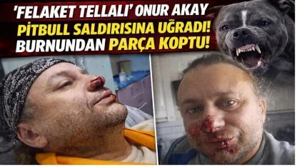 “Felaket Tellalı” Onur Akay’a Pitbull Saldırısı: Burnundan Parça Koptu
