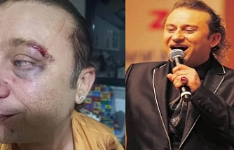 TSM sanatçısı Onur Akay, Akçay'da saldırıya uğradı